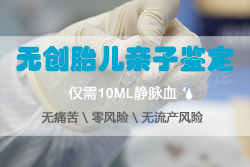在[郑州]刚怀孕如何办理亲子鉴定，郑州孕期亲子鉴定收费多少钱