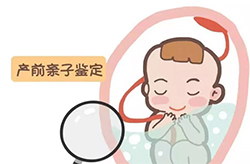 郑州怀孕亲子鉴定如何办理[专家咨询]